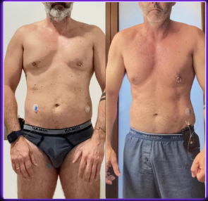 Antes y después de un cliente PRIME-X